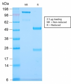 CD79b Antibody
