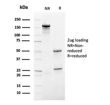 HSV1 Antibody / Herpes Simplex Virus Type I