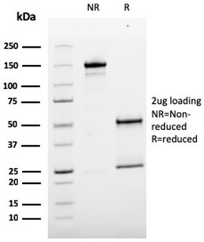 CD146 Antibody / MCAM / MUC18