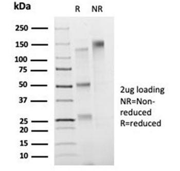 FOXB1 Antibody