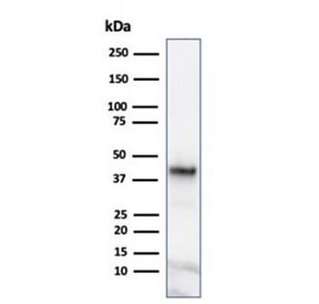 Glutamine Synthetase Antibody / GLUL