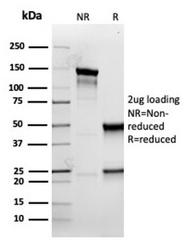Cytokeratin 5 Antibody / KRT5
