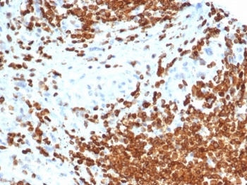 AMH Antibody / Anti-Muellerian Hormone
