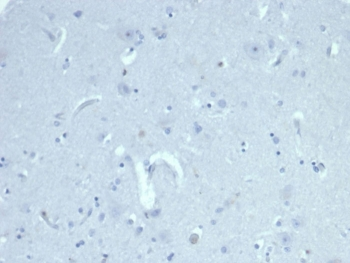 AMH Antibody / Anti-Muellerian Hormone