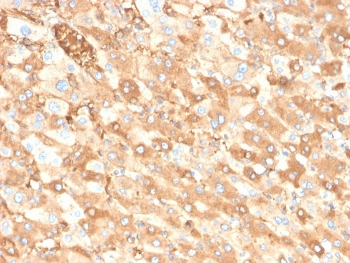 Albumin Antibody / ALB