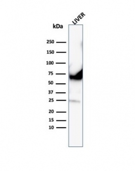 Albumin Antibody / ALB