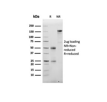 Albumin Antibody / ALB