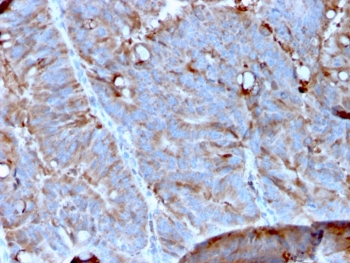 MerTK Antibody