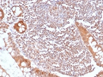Recombinant SMAD4 Antibody