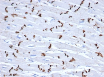N-Cadherin Antibody / CDH2