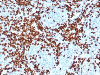 TdT Antibody / DNA nucleotidylexotransferase
