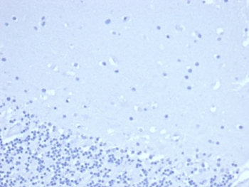 TdT Antibody / DNA nucleotidylexotransferase