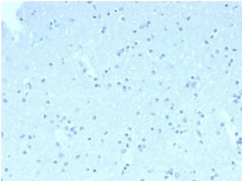 CD23 Antibody