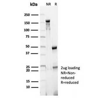 CD23 Antibody