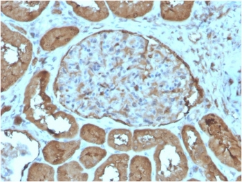 Laminin gamma 1 Antibody / LAMC1