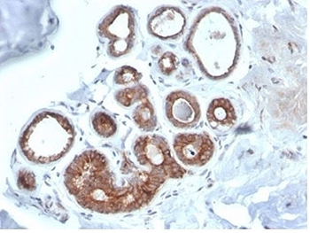 IGF1R Antibody / Insulin like growth factor 1 receptor