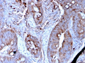 MerTK Antibody