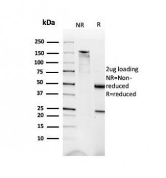 Dystrophin Antibody / DMD