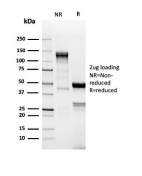 TdT Antibody / DNA nucleotidylexotransferase
