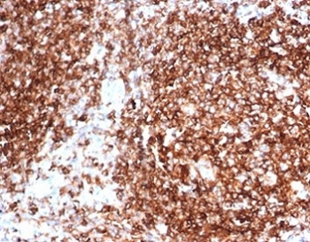Pan-HLA Antibody MHC II (DP/DQ/DR)