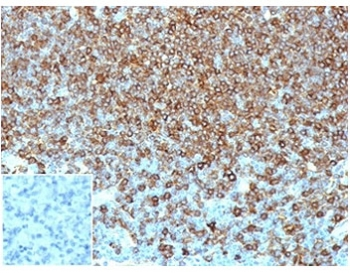 Pan-HLA Antibody MHC II (DP/DQ/DR)