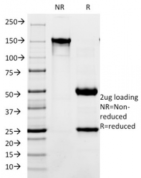 L1CAM Antibody / NCAM-L1 / CD171