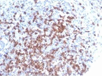 CD8A Antibody / CD8 alpha