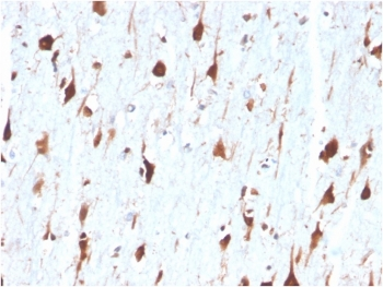 CA8 Antibody / Carbonic Anhydrase VIII