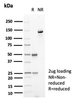 CA8 Antibody / Carbonic Anhydrase VIII