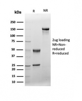 von Willebrand Factor Antibody / vWF