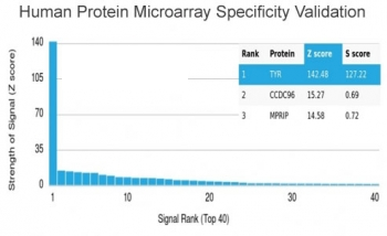 Tyrosinase Antibody / TYR