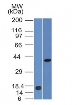PAX2 Antibody