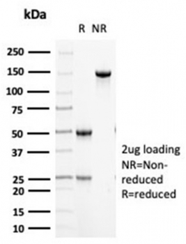Cytokeratin 5 Antibody / KRT5