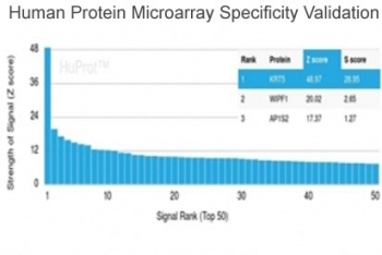 Cytokeratin 5 Antibody / KRT5