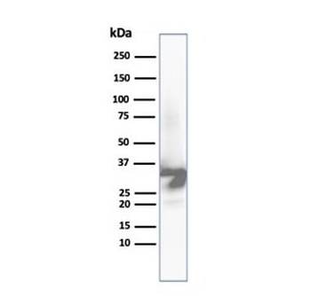 Arginase 1 Antibody
