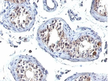 HGAL Antibody / GCSAM / GCET2