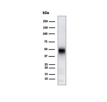 CD2 Antibody / Lymphocyte Function Antigen 2 / LFA-2