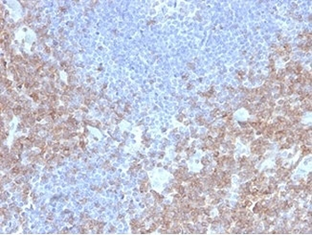 CD2 Antibody / Lymphocyte Function Antigen 2 / LFA-2