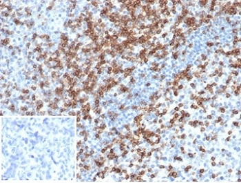 CD2 Antibody / Lymphocyte Function Antigen 2 / LFA-2