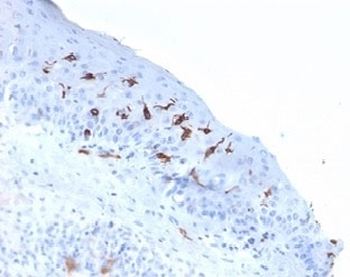 CD1a Antibody