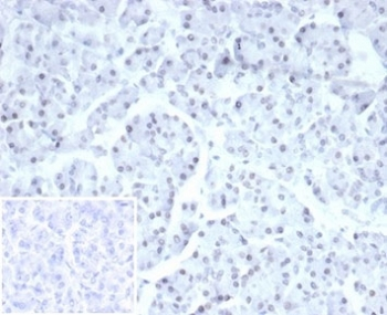 PHOX2B Antibody