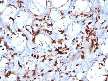 STAT6 Antibody