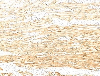 Smoothelin Antibody / SMSMO / SMTN