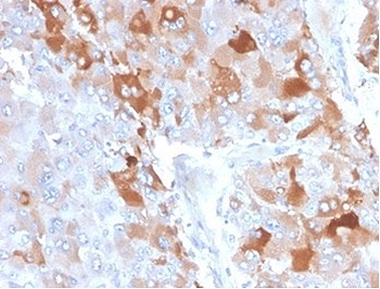 Clusterin Antibody / Apolipoprotein J / APO-J