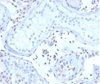 MGMT Antibody