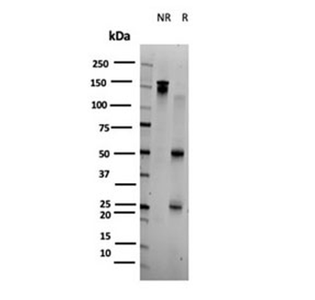 BOLA3 Antibody / BolA-like protein 3