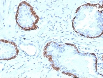 Cytokeratin 14 Antibody / CK14 / KRT14