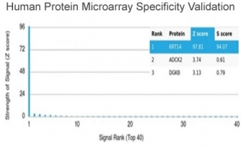 Cytokeratin 14 Antibody / CK14 / KRT14