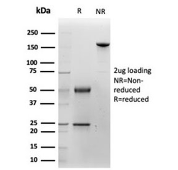 Cytokeratin 14 Antibody / CK14 / KRT14