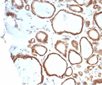HSP90 beta Antibody / HSP90AB1